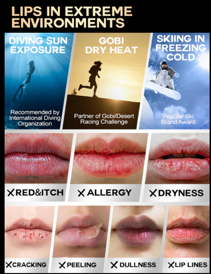 iLab Extreme Sports SOS Repair Lip Essential Balm